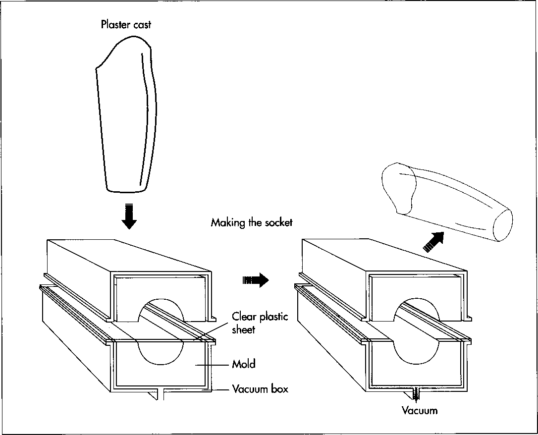 How are Artificial Limbs made? Tiếng Anh Kỹ Thuật